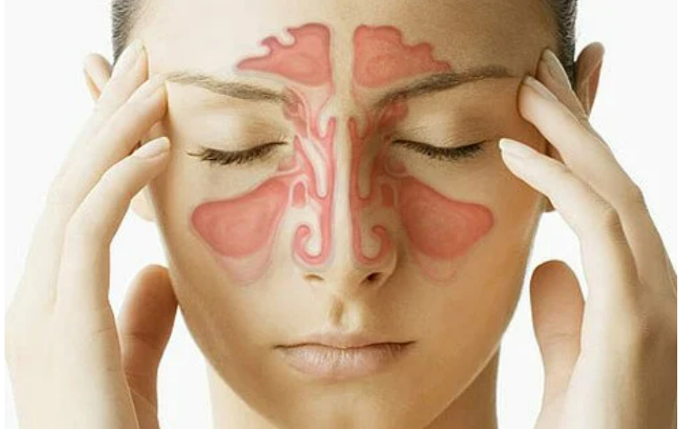 6 Signs of a Sinus Infection - Montgomery County ENT Institute